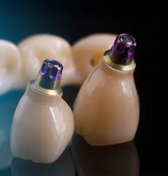 How An Implant Procedure